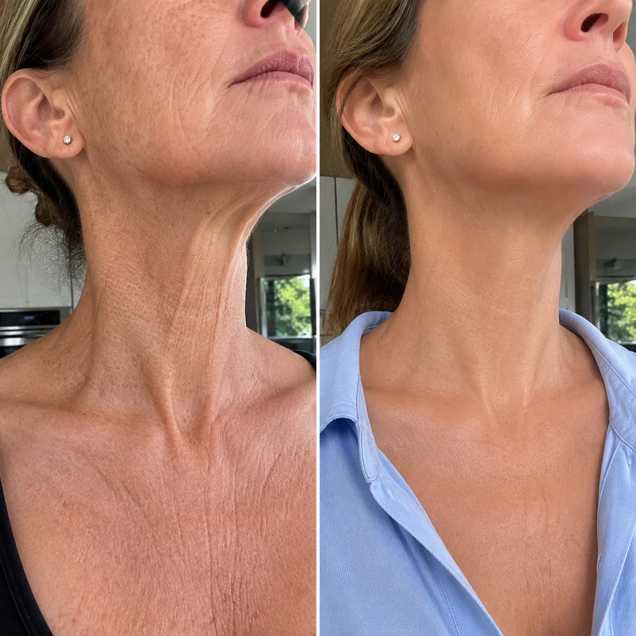 Joanne's neck before and after