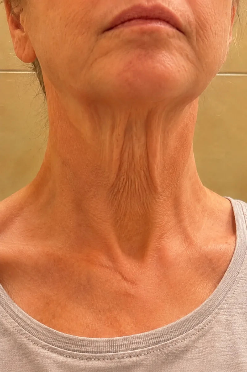 Week two skin texture illustration